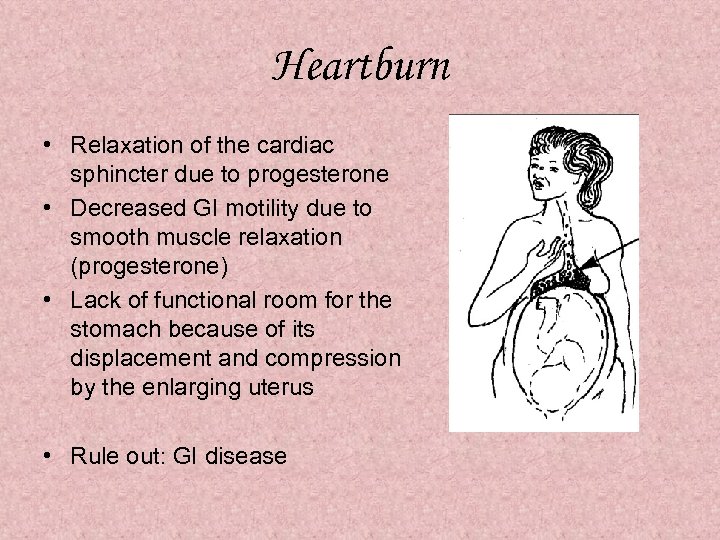 Heartburn • Relaxation of the cardiac sphincter due to progesterone • Decreased GI motility