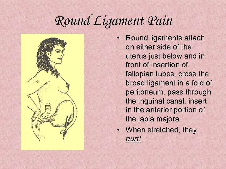 Round Ligament Pain • Round ligaments attach on either side of the uterus just