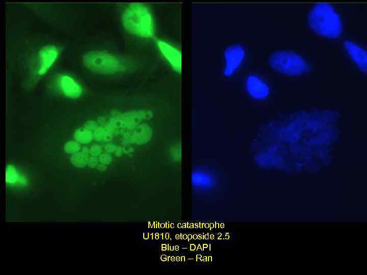 Mitotic catastrophe U 1810, etoposide 2. 5 Blue – DAPI Green – Ran 