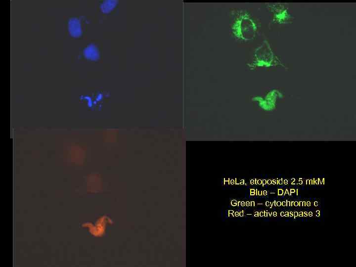 He. La, etoposide 2. 5 mk. M Blue – DAPI Green – cytochrome c