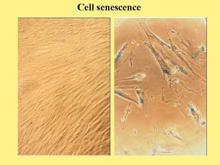 Cell senescence 