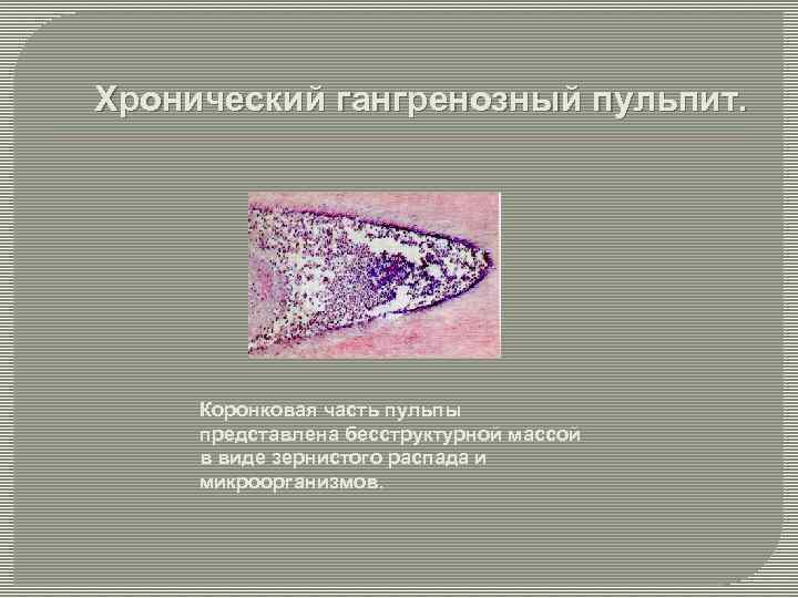 Хронический гангренозный пульпит. Коронковая часть пульпы представлена бесструктурной массой в виде зернистого распада и