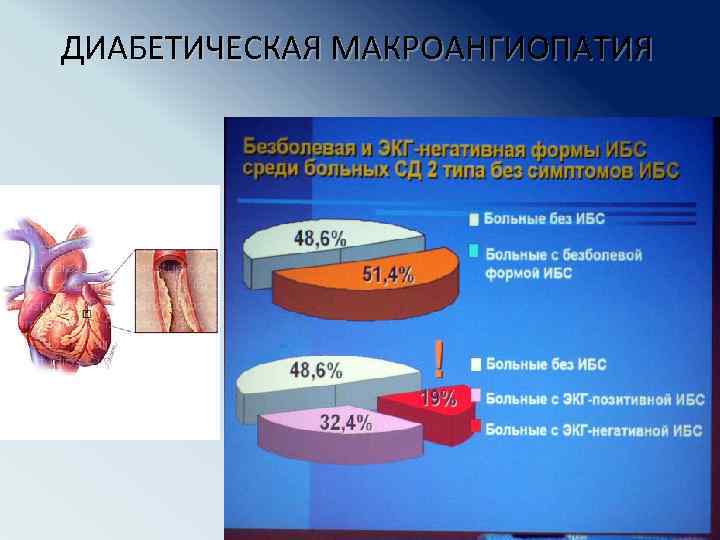 Диабетическая ангиопатия симптомы