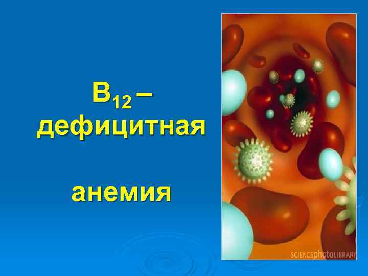 В 12 – дефицитная анемия 