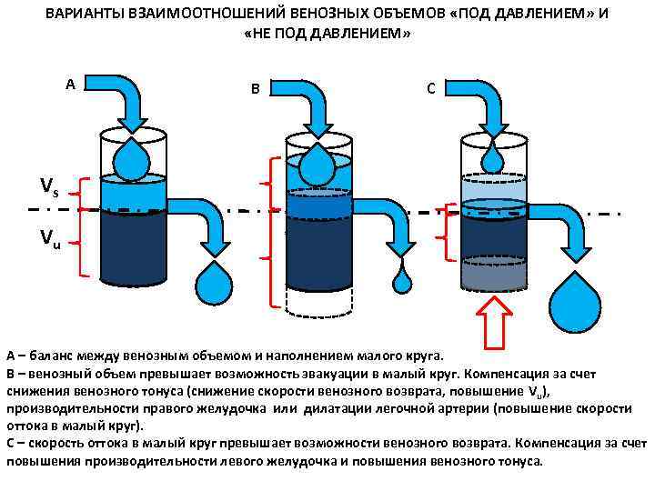ВАРИАНТЫ ВЗАИМООТНОШЕНИЙ ВЕНОЗНЫХ ОБЪЕМОВ «ПОД ДАВЛЕНИЕМ» И «НЕ ПОД ДАВЛЕНИЕМ» А B C Vs