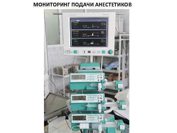 МОНИТОРИНГ ПОДАЧИ АНЕСТЕТИКОВ 