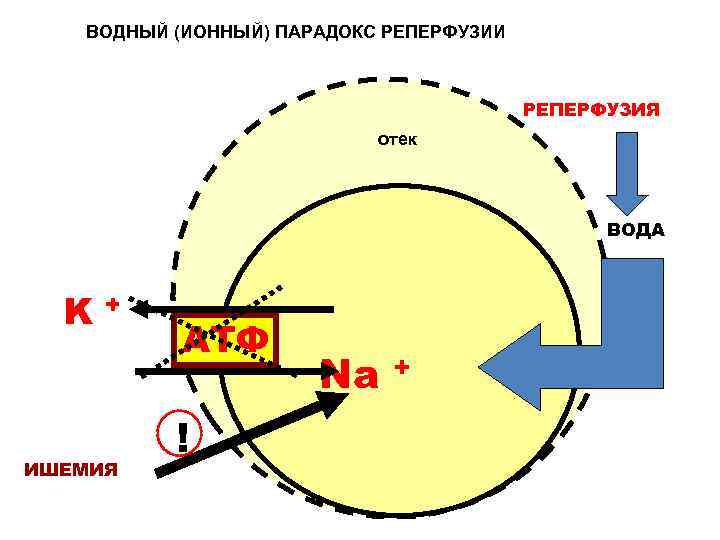 ВОДНЫЙ (ИОННЫЙ) ПАРАДОКС РЕПЕРФУЗИИ РЕПЕРФУЗИЯ отек ВОДА K+ ИШЕМИЯ АТФ ! Na + 