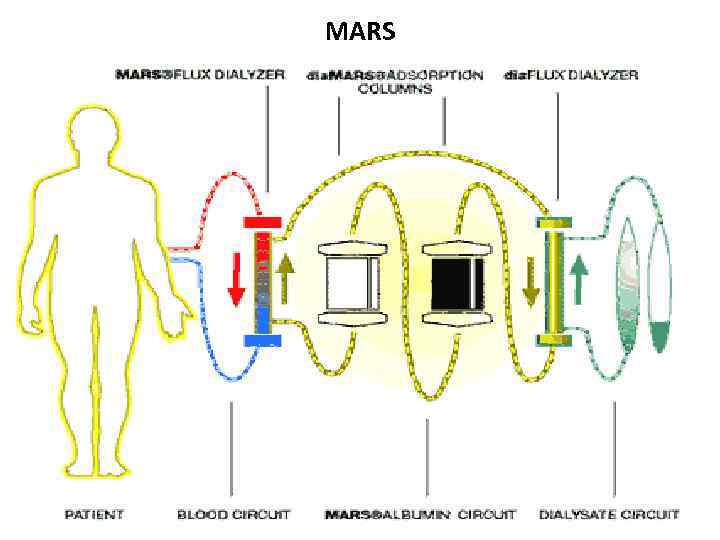 MARS 