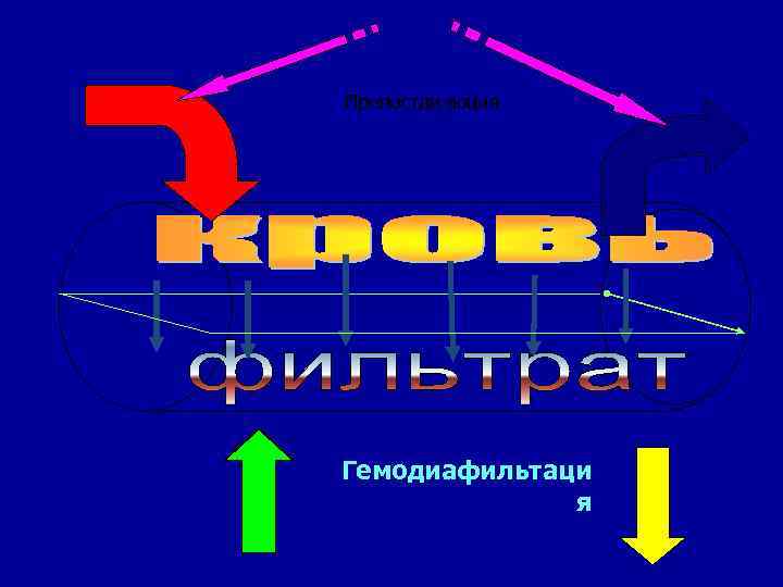 Препостдилюция Гемодиафильтаци я 