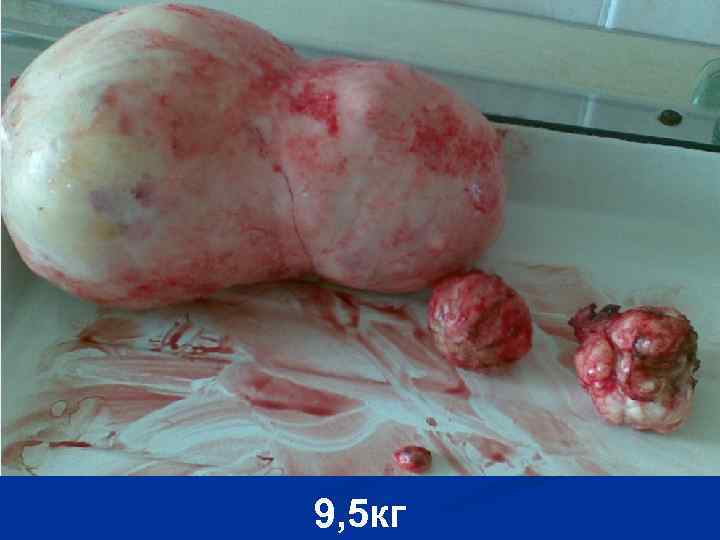 9, 5 кг 