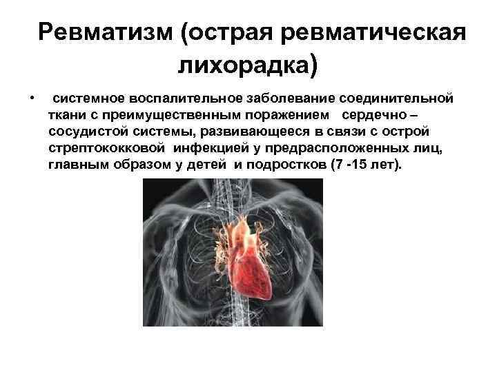 Острая ревматическая лихорадка у детей картинки