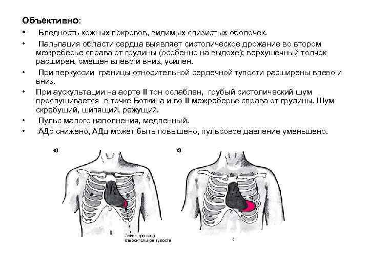 Объективно: • Бледность кожных покровов, видимых слизистых оболочек. • • • Пальпация области сердца