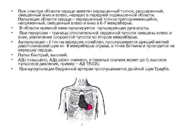  • • При осмотре области сердца заметен верхушечный толчок, расширенный, смещенный вниз и