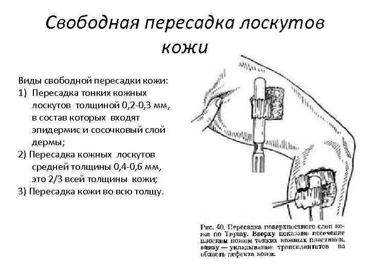 Пластика с применением свободной пересадки тканей презентация