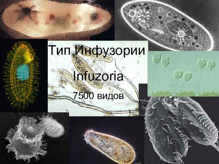 Тип Инфузории Infuzoria 7500 видов Infuzoria 