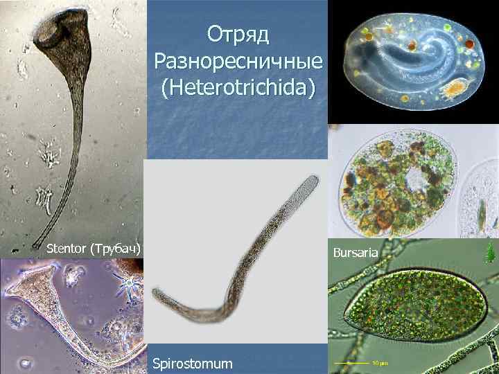 Отряд Разноресничные (Heterotrichida) Stentor (Трубач) Bursaria Spirostomum 
