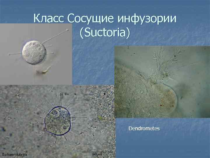Класс Сосущие инфузории (Suctoria) Dendrometes 