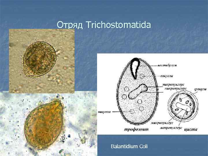 Балантидий строение рисунок