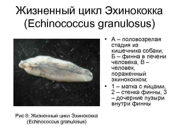 Жизненный цикл Эхинококка (Echinococcus granulosus) • А – половозрелая стадия из кишечника собаки, Б