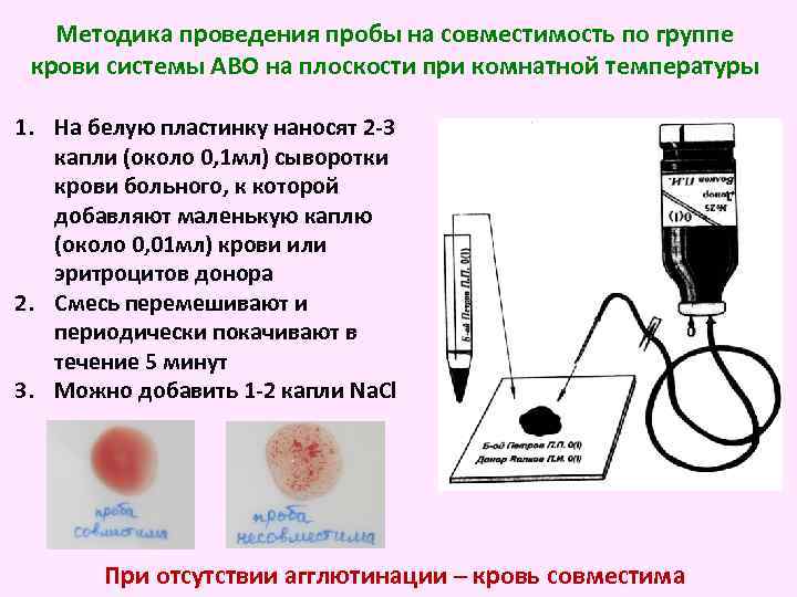 Методика проведения пробы на совместимость по группе крови системы АВО на плоскости при комнатной