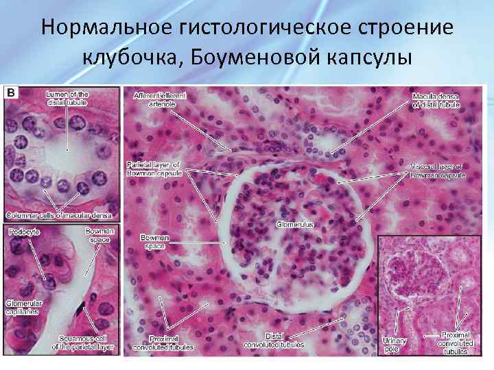 Нормальное гистологическое строение клубочка, Боуменовой капсулы 