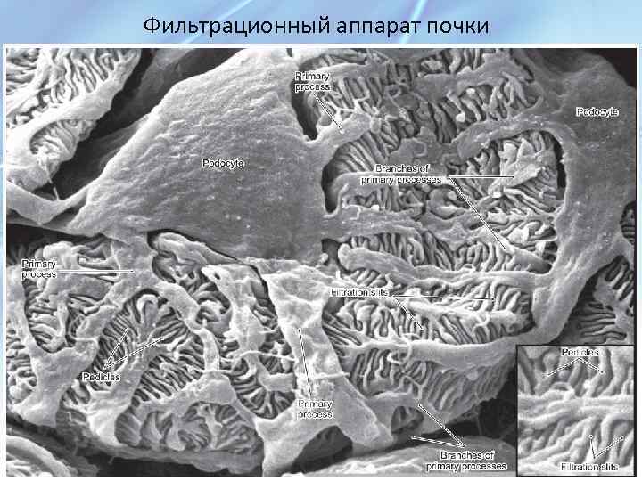 Фильтрационный аппарат почки 