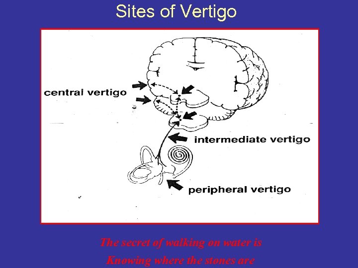 Sites of Vertigo The secret of walking on water is Knowing where the stones