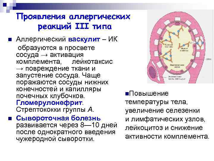 Проявления аллергических реакций III типа n n Аллергический васкулит – ИК образуются в просвете