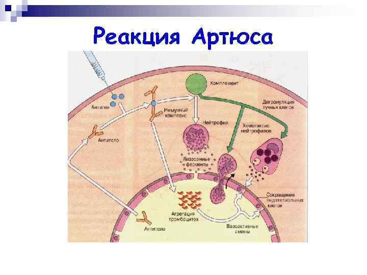 Реакция Артюса 