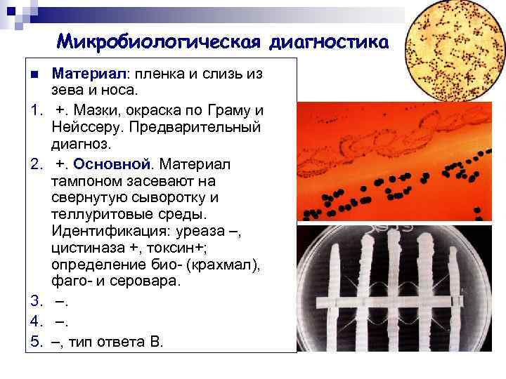 Микробиологическая диагностика n 1. 2. 3. 4. 5. Материал: пленка и слизь из зева