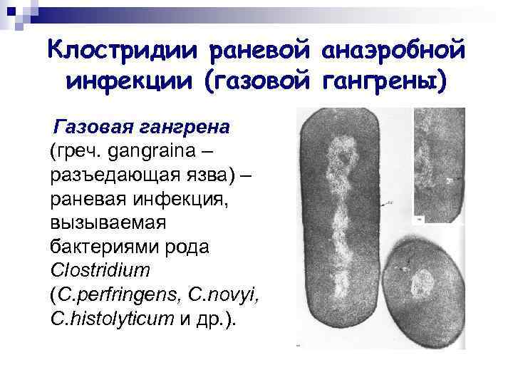 Клостридии раневой анаэробной инфекции (газовой гангрены) Газовая гангрена (греч. gangraina – разъедающая язва) –