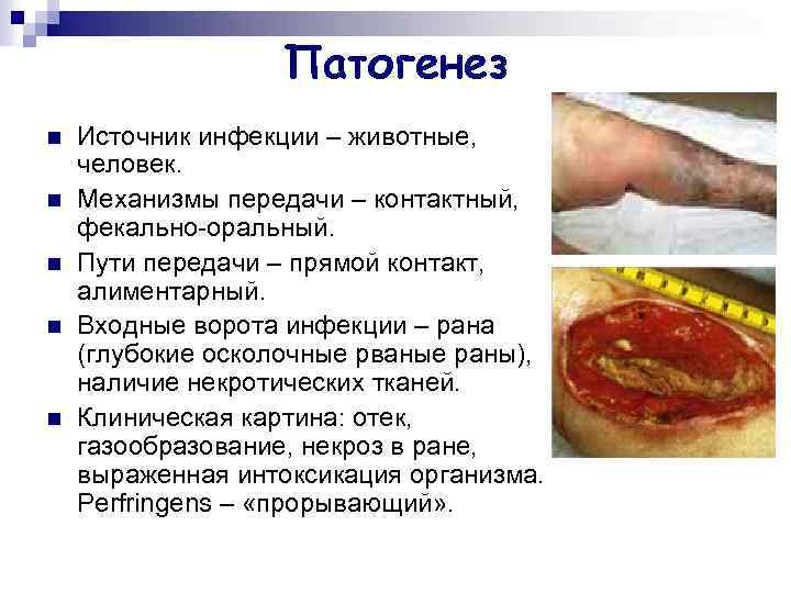 Патогенез n n n Источник инфекции – животные, человек. Механизмы передачи – контактный, фекально-оральный.
