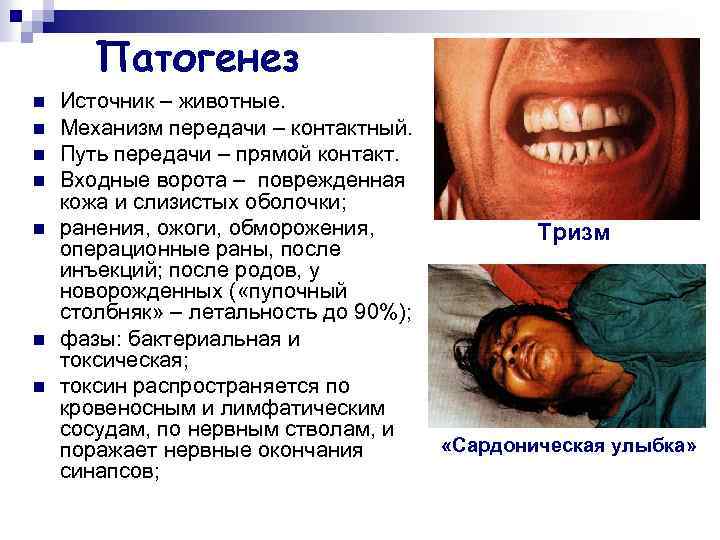 Патогенез n n n n Источник – животные. Механизм передачи – контактный. Путь передачи