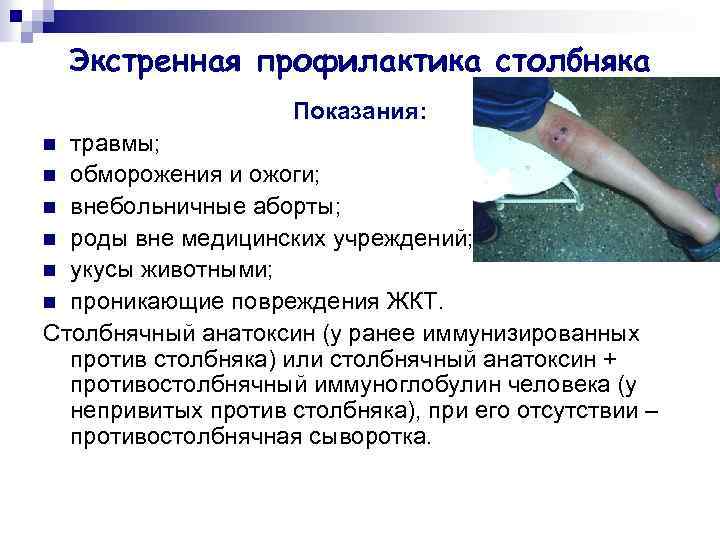 Экстренная профилактика столбняка Показания: травмы; n обморожения и ожоги; n внебольничные аборты; n роды