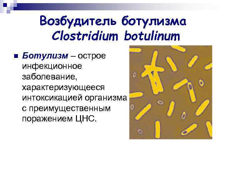 Возбудитель ботулизма Clostridium botulinum n Ботулизм – острое инфекционное заболевание, характеризующееся интоксикацией организма с