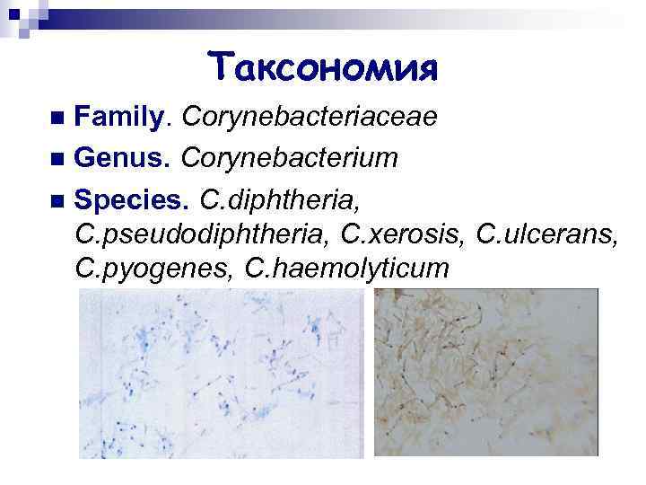 Таксономия Family. Corynebacteriaceae n Genus. Corynebacterium n Species. C. diphtheria, C. pseudodiphtheria, C. xerosis,