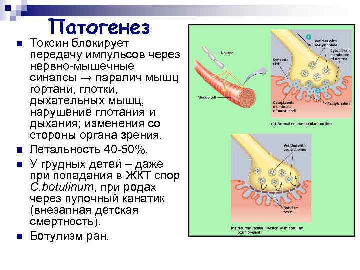 n n Патогенез Токсин блокирует передачу импульсов через нервно-мышечные синапсы → паралич мышц гортани,