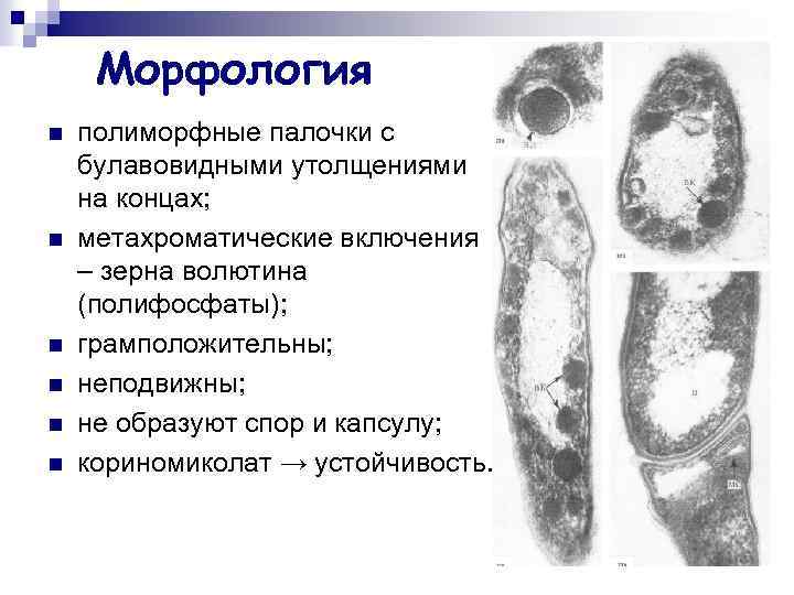 Морфология n n n полиморфные палочки с булавовидными утолщениями на концах; метахроматические включения –