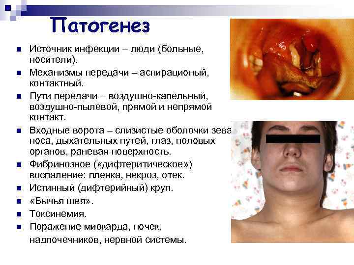 Патогенез n n n n n Источник инфекции – люди (больные, носители). Механизмы передачи