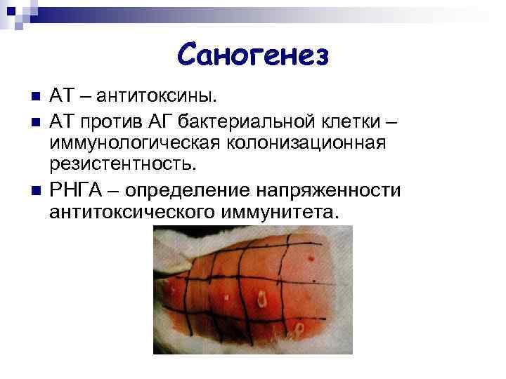 Саногенез n n n АТ – антитоксины. АТ против АГ бактериальной клетки – иммунологическая