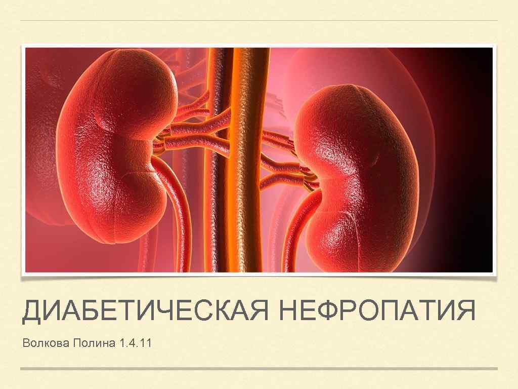 ДИАБЕТИЧЕСКАЯ НЕФРОПАТИЯ Волкова Полина 1. 4. 11 