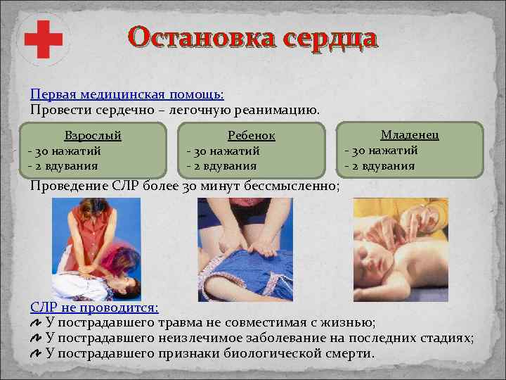 Остановка сердца Первая медицинская помощь: Провести сердечно – легочную реанимацию. Взрослый - 30 нажатий