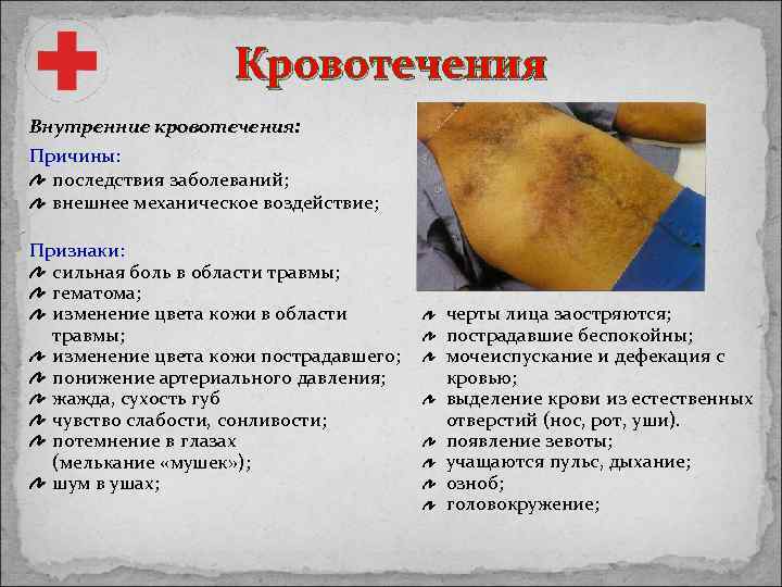 Кровотечения Внутренние кровотечения: Причины: последствия заболеваний; внешнее механическое воздействие; Признаки: сильная боль в области