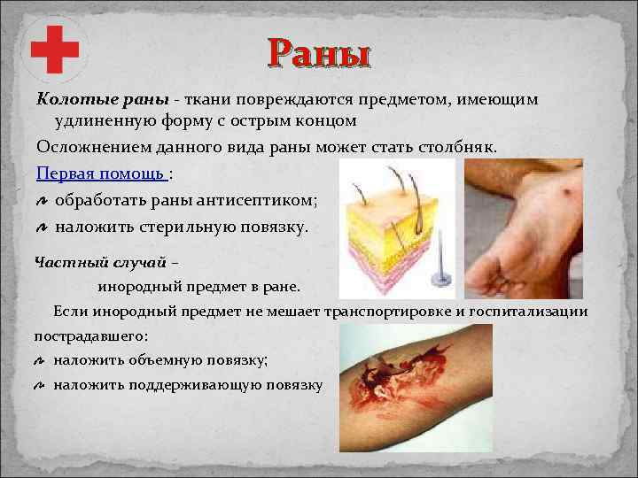 Раны Колотые раны - ткани повреждаются предметом, имеющим удлиненную форму с острым концом Осложнением