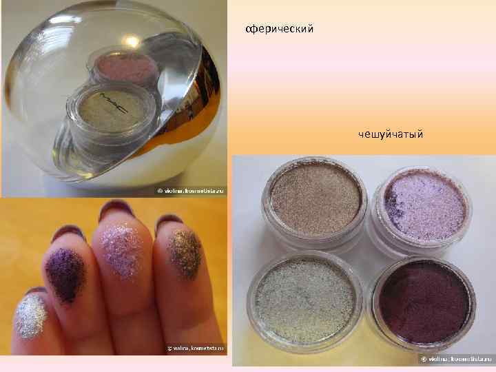 сферический чешуйчатый 