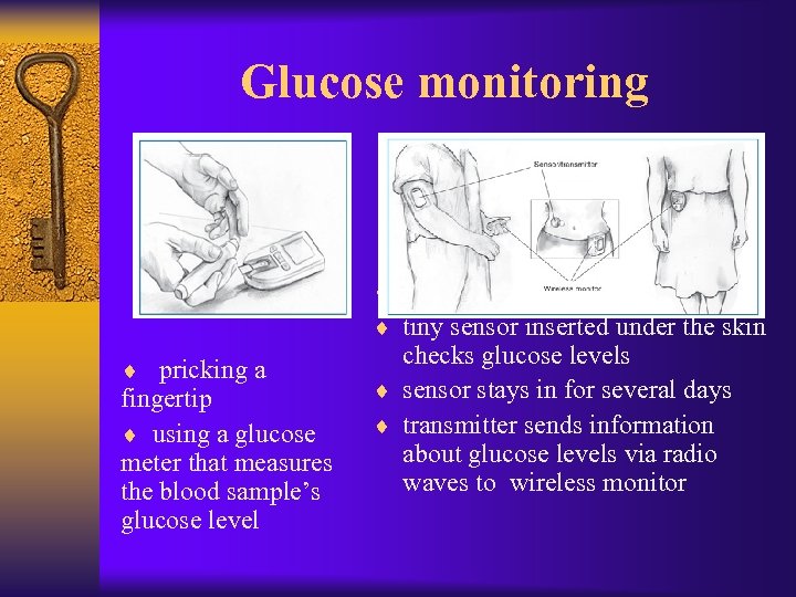 Glucose monitoring ¨ Continuous glucose monitoring ¨ tiny sensor inserted under the skin ¨