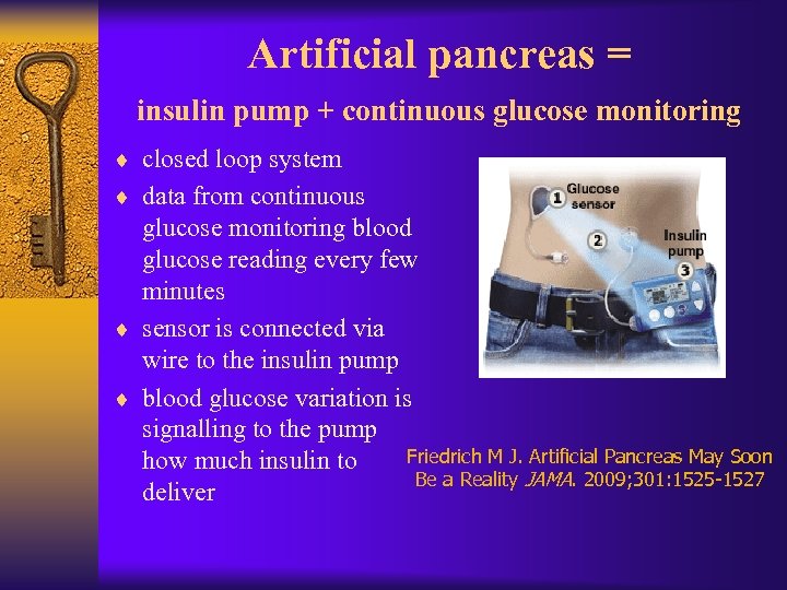 Artificial pancreas = insulin pump + continuous glucose monitoring ¨ closed loop system ¨