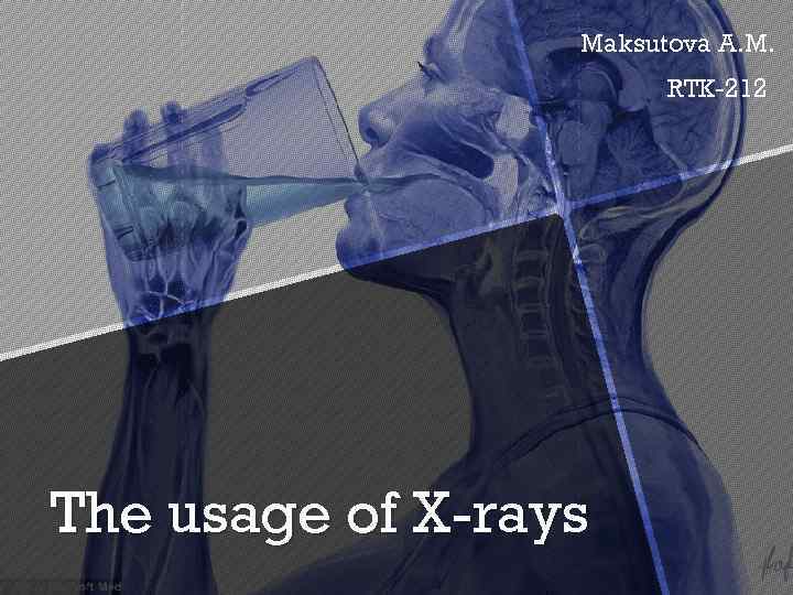 Maksutova A. M. RTK-212 The usage of X-rays 