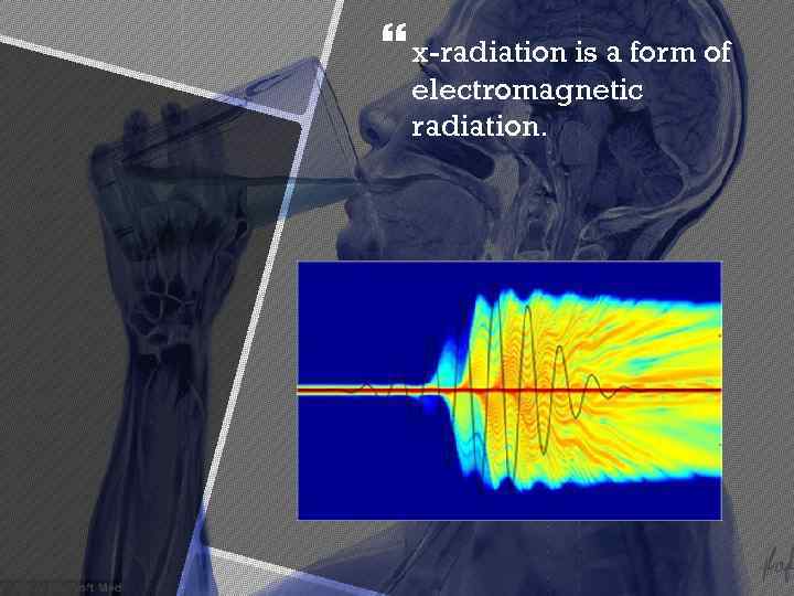  x-radiation is a form of electromagnetic radiation. 