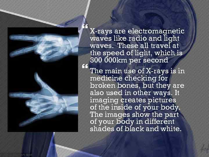  X-rays are electromagnetic waves like radio and light waves. These all travel at